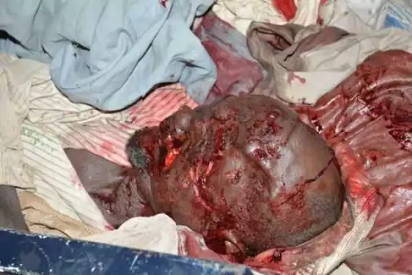 Suspected Ritualists Murder Elderly Man in Zamfara State with His Eyes and Body Parts Missing (Graphic Photo)